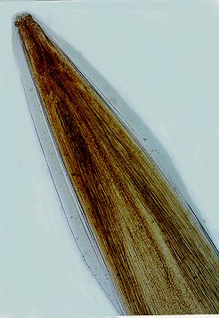 Toxocara canis